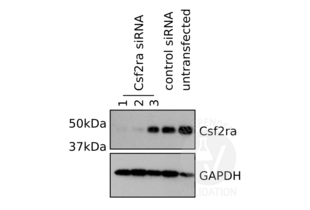 CSF2RA anticorps  (Center)