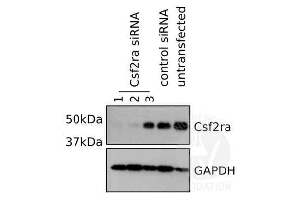 CSF2RA anticorps  (Center)