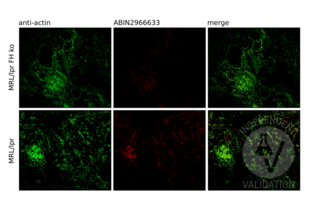 Immunofluorescence validation image for anti-Four and A Half LIM Domains 1 (FHL1) antibody (ABIN2966633) (FHL1 anticorps)