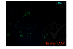 Immunofluorescence validation image for anti-Amyloid beta (A4) Precursor Protein (APP) (AA 666-670) antibody (ABIN197433) (APP anticorps  (AA 666-670))