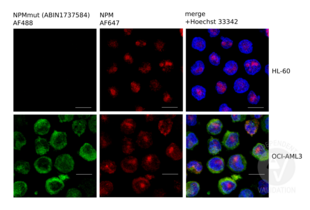 Immunofluorescence validation image for anti-Nucleophosmin (Nucleolar phosphoprotein B23, Numatrin) (NPM1) (AA 250-298), (C-Term) antibody (ABIN1737584) (NPM1 anticorps  (C-Term))
