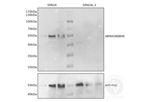 Western Blotting validation image for anti-Sperm Associated Antigen 4 (SPAG4) antibody (ABIN4368846) (SPAG4 anticorps)