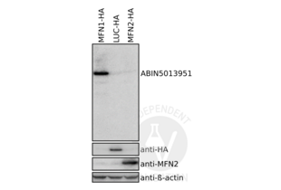 Western Blotting validation image for anti-Mitofusin 1 (MFN1) (AA 1-234) antibody (ABIN5013951) (MFN1 anticorps  (AA 1-234))