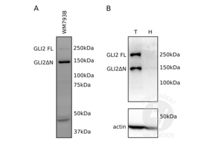 Western Blotting validation image for anti-GLI Family Zinc Finger 2 (GLI2) (Middle Region) antibody (ABIN2777474) (GLI2 anticorps  (Middle Region))
