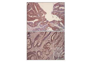 Immunohistochemistry validation image for anti-GLI Family Zinc Finger 2 (GLI2) (Middle Region) antibody (ABIN2777474) (GLI2 anticorps  (Middle Region))