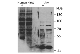 Western Blotting validation image for anti-Hyaluronidase-1 (HYAL1) (N-Term) antibody (ABIN2784342) (HYAL1 anticorps  (N-Term))