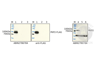 Western Blotting validation image for anti-Plakophilin 2 (PKP2) (N-Term) antibody (ABIN2786784) (Plakophilin 2 anticorps  (N-Term))