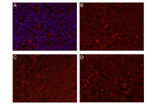 Immunohistochemistry (Formalin-fixed Paraffin-embedded Sections) validation image for anti-C-Type Lectin Domain Family 14, Member A (CLEC14A) (AA 260-310) antibody (ABIN1385496) (CLEC14A anticorps  (AA 260-310))