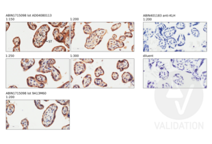 Immunohistochemistry validation image for anti-CD200 Receptor 1-Like (CD200R1L) (AA 151-250) antibody (ABIN1715098) (CD200R1L anticorps  (AA 151-250))