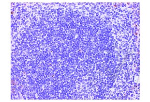 Immunohistochemistry validation image for anti-CD4 (CD4) (AA 385-457) antibody (ABIN671376) (CD4 anticorps  (AA 385-457))