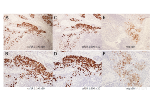 Immunohistochemistry validation image for anti-Colony Stimulating Factor 1 Receptor (CSF1R) (pTyr723) antibody (ABIN683788) (CSF1R anticorps  (pTyr723))