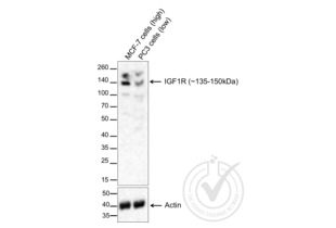 Western Blotting validation image for anti-Insulin-Like Growth Factor 1 Receptor (IGF1R) (AA 251-350) antibody (ABIN726575) (IGF1R anticorps  (AA 251-350))