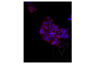 Immunofluorescence validation image for anti-Low Density Lipoprotein Receptor-Related Protein 2 (LRP2) (AA 3401-3500) antibody (Cy3) (ABIN750991) (LRP2 anticorps  (AA 3401-3500) (Cy3))