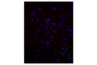 Immunofluorescence validation image for anti-Low Density Lipoprotein Receptor-Related Protein 2 (LRP2) (AA 3401-3500) antibody (Cy3) (ABIN750991) (LRP2 anticorps  (AA 3401-3500) (Cy3))
