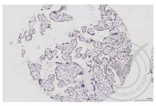 Immunohistochemistry validation image for anti-Mitogen-Activated Protein Kinase Kinase 1 (MAP2K1) (AA 2-150) antibody (ABIN686482) (MEK1 anticorps  (AA 2-150))