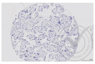 Immunohistochemistry validation image for anti-Mitogen-Activated Protein Kinase Kinase 1 (MAP2K1) (AA 2-150) antibody (ABIN686482) (MEK1 anticorps  (AA 2-150))