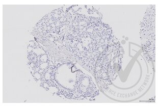 Immunohistochemistry validation image for anti-Mitogen-Activated Protein Kinase Kinase 5 (MAP2K5) (AA 251-350) antibody (ABIN754183) (MAP2K5 anticorps  (AA 251-350))