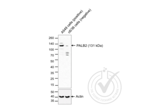 Western Blotting validation image for anti-Partner and Localizer of BRCA2 (PALB2) (AA 1101-1186) antibody (ABIN670536) (PALB2 anticorps  (AA 1101-1186))
