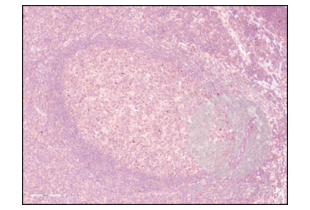 Immunohistochemistry validation image for anti-Programmed Cell Death 1 (PDCD1) (AA 201-288) antibody (ABIN735608) (PD-1 anticorps  (AA 201-288))