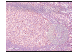 Immunohistochemistry validation image for anti-Programmed Cell Death 1 (PDCD1) (AA 201-288) antibody (ABIN735608) (PD-1 anticorps  (AA 201-288))