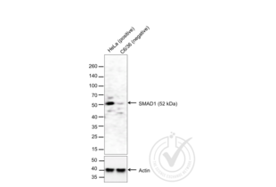 Western Blotting validation image for anti-Smad1/5 Protein (SMAD1/5) (AA 361-465) antibody (ABIN732158) (Smad1/5 anticorps  (AA 361-465))