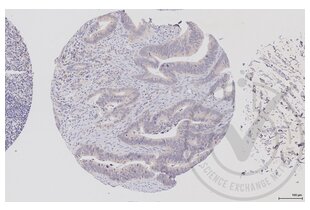 Immunohistochemistry validation image for anti-V-Raf-1 Murine Leukemia Viral Oncogene Homolog 1 (RAF1) (AA 31-130) antibody (ABIN733208) (RAF1 anticorps  (AA 31-130))