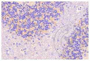 Immunohistochemistry validation image for anti-Clathrin (AA 4-171) antibody (ABIN968006) (Clathrin anticorps  (AA 4-171))