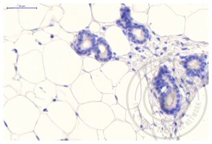 Immunohistochemistry validation image for anti-Clathrin (AA 4-171) antibody (ABIN968006) (Clathrin anticorps  (AA 4-171))