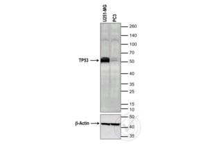 Western Blotting validation image for anti-Tumor Protein P53 (TP53) (full length) antibody (ABIN967416) (p53 anticorps  (full length))