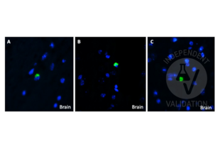 Immunohistochemistry validation image for anti-Amyloid beta (Abeta) (C-Term) antibody (ABIN5508784) (beta Amyloid anticorps  (C-Term))