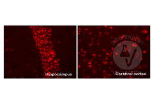 Immunohistochemistry validation image for anti-Amyloid beta (Abeta) (C-Term) antibody (ABIN5508784) (beta Amyloid anticorps  (C-Term))