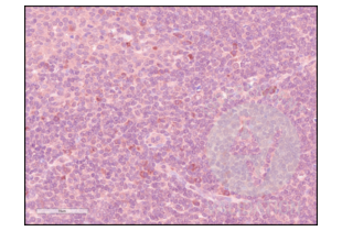 Immunohistochemistry validation image for anti-CD84 (CD84) (Internal Region) antibody (ABIN3187786) (CD84 anticorps  (Internal Region))