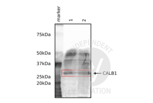 Western Blotting validation image for anti-Calbindin (CALB1) antibody (ABIN6254097) (CALB1 anticorps)