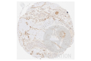 Immunohistochemistry validation image for anti-Collagen, Type III (COL3) antibody (ABIN5596830)