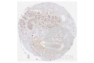 Immunohistochemistry validation image for anti-Collagen, Type III (COL3) antibody (ABIN5596830)