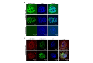 Immunocytochemistry validation image for anti-DYKDDDDK Tag antibody (ABIN3181074) (DYKDDDDK Tag anticorps)