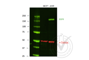 Western Blotting validation image for anti-Epidermal Growth Factor Receptor (EGFR) antibody (ABIN98862) (EGFR anticorps)