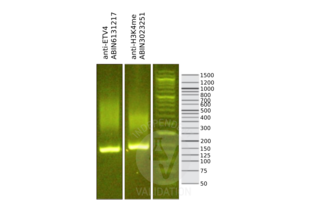Cleavage Under Targets and Release Using Nuclease validation image for anti-Ets Variant 4 (ETV4) (AA 1-207) antibody (ABIN6131217) (ETV4 anticorps  (AA 1-207))
