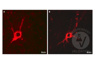Immunohistochemistry validation image for anti-Glutamate Decarboxylase 1 (Brain, 67kDa) (GAD1) (C-Term) antibody (ABIN3184725) (GAD anticorps  (C-Term))