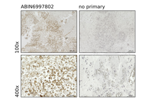 Immunohistochemistry validation image for anti-Myosin IF (MYO1F) (AA 491-767) antibody (ABIN6997802) (MYO1F anticorps  (AA 491-767))