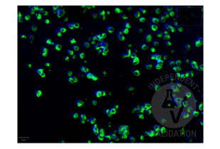 Recombinant SARS-CoV-2 Spike S1 anticorps  (RBD)