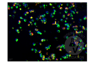 Multiplex Immunohistochemistry validation image for anti-SARS-CoV-2 Spike S1 (RBD) antibody (ABIN6952546) (Recombinant SARS-CoV-2 Spike S1 anticorps  (RBD))