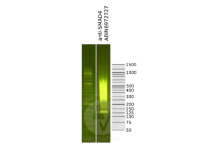 Cleavage Under Targets and Release Using Nuclease validation image for anti-SMAD Family Member 4 (SMAD4) (N-Term) antibody (ABIN6972727) (SMAD4 anticorps  (N-Term))