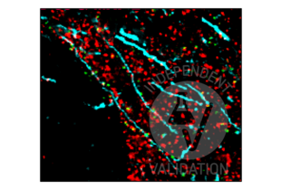 Multiplex Immunohistochemistry validation image for anti-Synapsin I (SYN1) (AA 362-511) antibody (ABIN5542390) (SYN1 anticorps  (AA 362-511))
