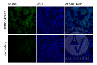 Immunofluorescence validation image for anti-Toll-Like Receptor 9 (TLR9) (AA 868-1016) antibody (ABIN5542492) (TLR9 anticorps  (AA 868-1016))