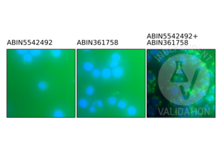 Proximity Ligation Assay validation image for anti-Toll-Like Receptor 9 (TLR9) (AA 868-1016) antibody (ABIN5542492) (TLR9 anticorps  (AA 868-1016))