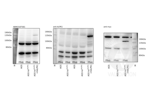 Western Blotting validation image for anti-alpha-Kinase 1 (ALPK1) (N-Term) antibody (ABIN3187581) (ALPK1 anticorps  (N-Term))