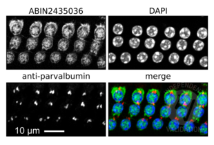 Immunofluorescence validation image for anti-Myosin VIIA (MYO7A) antibody (ABIN2435036) (Myosin VIIA anticorps)