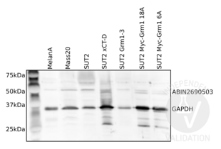 Western Blotting validation image for anti-Solute Carrier Family 1 (Glial High Affinity Glutamate Transporter), Member 3 (SLC1A3) (Cytoplasmic Domain) antibody (ABIN2690503) (SLC1A3 anticorps  (Cytoplasmic Domain))