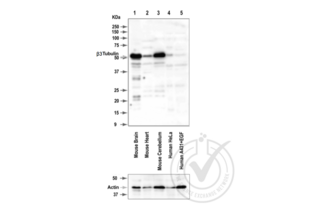 Western Blotting validation image for anti-Tubulin, beta 3 (TUBB3) (AA 443-450) antibody (ABIN1742553) (TUBB3 anticorps  (AA 443-450))